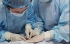 新生儿PICC置管术，为早产儿生命助力