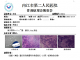 为什么还要做免疫组化染色检测