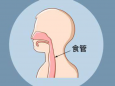 【健康科普】认识食管癌，早筛早发现