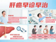 肝癌的生存希望来自于早诊早治