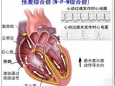 心跳的“短路”现象：揭开心室预激的神秘面纱